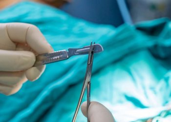 Fakta Kasus Perkosaan Mojokerto