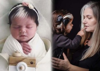 Bayi Dengan Gen Langka