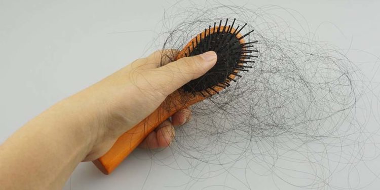 Obat Untuk Rambut Rontok