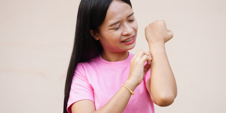 Gejala Penyakit Cacar Monyet